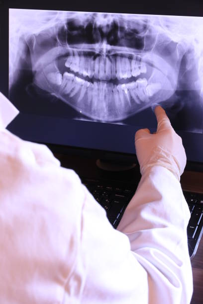 Best Emergency Treatment for Toothache in Orinda, CA