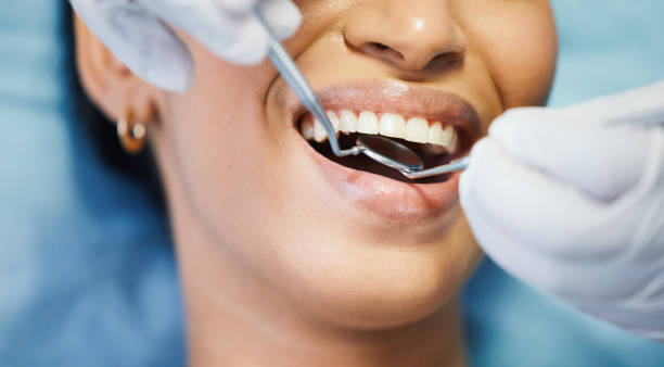 Best Emergency Broken Tooth Repair in Orinda, CA