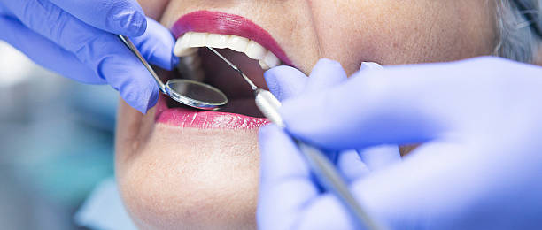 Best Emergency Treatment for Toothache in Orinda, CA